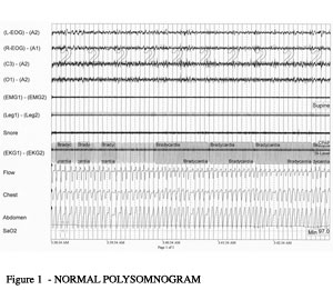 fig1_poly_sm