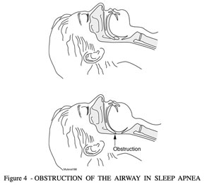 fig4_sm